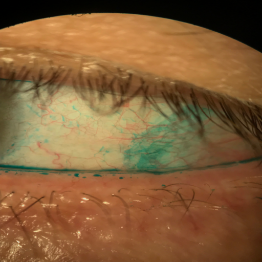 LG-Staining-Eyeball Sclera-raw
